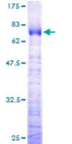 Novus Biologicals Recombinant Human TFIISH GST (N-Term) Protein 10 &mu;g | Buy Online | Novus Biologicals&trade; | Fisher Scientific