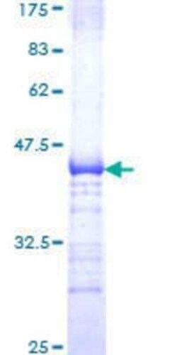Novus Biologicals Recombinant Human TCF-3/E2A GST (N-Term) Protein 10 &mu;g | Buy Online | Novus Biologicals&trade; | Fisher Scientific