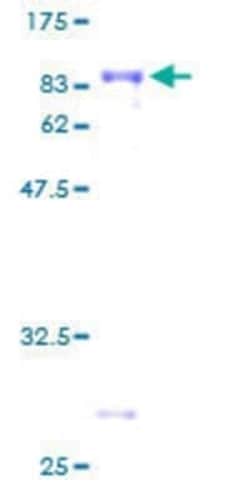 Novus Biologicals Recombinant Human TCF7L2 GST (N-Term) Protein 2 &mu;g | Buy Online | Novus Biologicals&trade; | Fisher Scientific