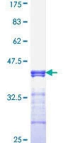 Novus Biologicals Recombinant Human TCF7L2 GST (N-Term) Protein 25 &mu;g | Buy Online | Novus Biologicals&trade; | Fisher Scientific