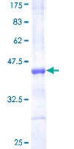 Novus Biologicals Recombinant Human TCF-12/HTF4 GST (N-Term) Protein 10 &mu;g | Buy Online | Novus Biologicals&trade; | Fisher Scientific
