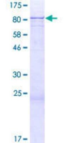 Novus Biologicals Recombinant Human ZNF354A GST (N-Term) Protein 2 &mu;g | Buy Online | Novus Biologicals&trade; | Fisher Scientific