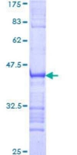 Novus Biologicals Recombinant Human ZNF354A GST (N-Term) Protein 25 &mu;g | Buy Online | Novus Biologicals&trade; | Fisher Scientific