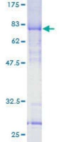 Novus Biologicals Recombinant Human YL1 GST (N-Term) Protein 2 &mu;g | Buy Online | Novus Biologicals&trade; | Fisher Scientific