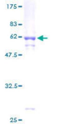 Novus Biologicals Recombinant Human mLX GST (N-Term) Protein 2 &mu;g | Buy Online | Novus Biologicals&trade; | Fisher Scientific