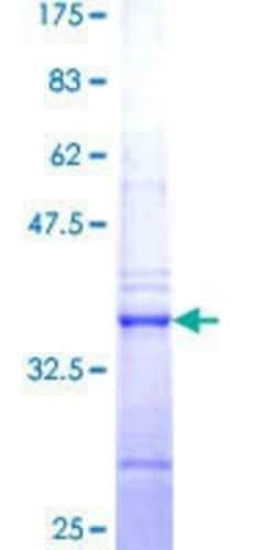 Novus Biologicals Recombinant Human Treacher Collins syndrome protein GST (N-Term) Protein 25 &mu;g | Buy Online | Novus Biologicals&trade; | Fisher Scientific