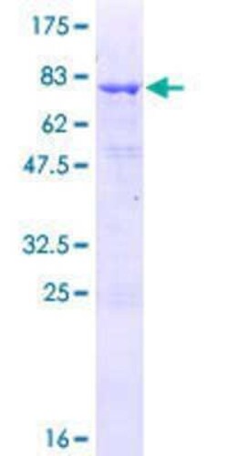 Novus Biologicals Recombinant Human TCP10 GST (N-Term) Protein 10 &mu;g | Buy Online | Novus Biologicals&trade; | Fisher Scientific