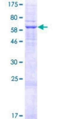 Novus Biologicals Recombinant Human TCR alpha GST (N-Term) Protein 2 &mu;g | Buy Online | Novus Biologicals&trade; | Fisher Scientific