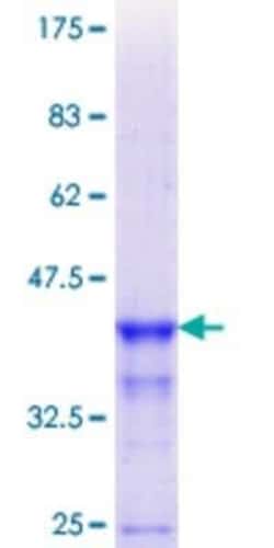 Novus Biologicals Recombinant Human TCR alpha GST (N-Term) Protein 10 &mu;g | Buy Online | Novus Biologicals&trade; | Fisher Scientific