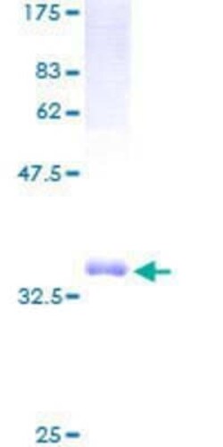 Novus Biologicals Recombinant Human TCTA GST (N-Term) Protein 2 &mu;g | Buy Online | Novus Biologicals&trade; | Fisher Scientific