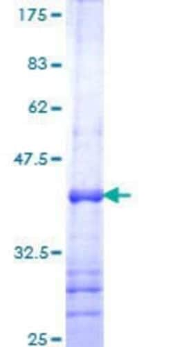 Novus Biologicals Recombinant Human TEAD4 GST (N-Term) Protein 25 &mu;g | Buy Online | Novus Biologicals&trade; | Fisher Scientific
