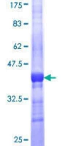 Novus Biologicals Recombinant Human Tectorin alpha GST (N-Term) Protein 10 &mu;g | Buy Online | Novus Biologicals&trade; | Fisher Scientific