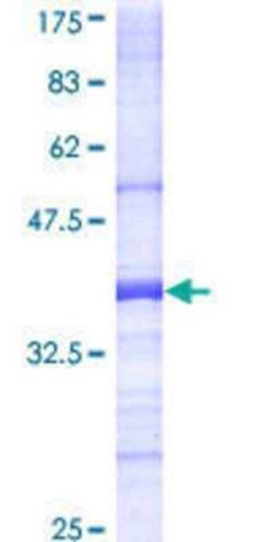 Novus Biologicals Recombinant Human TESK1 GST (N-Term) Protein 10 &mu;g | Buy Online | Novus Biologicals&trade; | Fisher Scientific