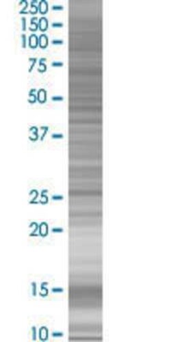 Novus Biologicals mtTFA 293T Cell Transient Overexpression Lysate 0.1 mL | Buy Online | Novus Biologicals&trade; | Fisher Scientific