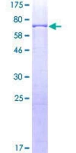 Novus Biologicals Recombinant Human AP2 alpha GST (N-Term) Protein 25 &mu;g | Buy Online | Novus Biologicals&trade; | Fisher Scientific