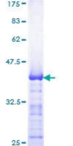Novus Biologicals Recombinant Human AP-2 beta/TFAP2B GST (N-Term) Protein 25 &mu;g | Buy Online | Novus Biologicals&trade; | Fisher Scientific