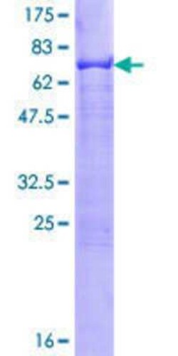 Novus Biologicals Recombinant Human AP-2 gamma GST (N-Term) Protein 2 &mu;g | Buy Online | Novus Biologicals&trade; | Fisher Scientific