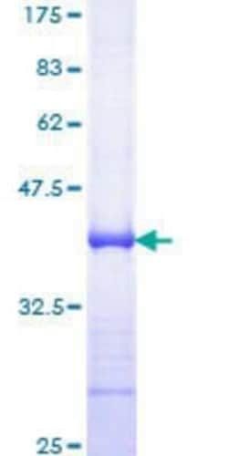 Novus Biologicals Recombinant Human AP-2 gamma GST (N-Term) Protein 10 &mu;g | Buy Online | Novus Biologicals&trade; | Fisher Scientific