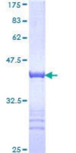Novus Biologicals Recombinant Human TFAP4 GST (N-Term) Protein 25 &mu;g | Buy Online | Novus Biologicals&trade; | Fisher Scientific