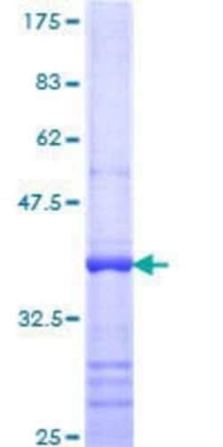 Novus Biologicals Recombinant Human TFCP2 GST (N-Term) Protein 25 &mu;g | Buy Online | Novus Biologicals&trade; | Fisher Scientific