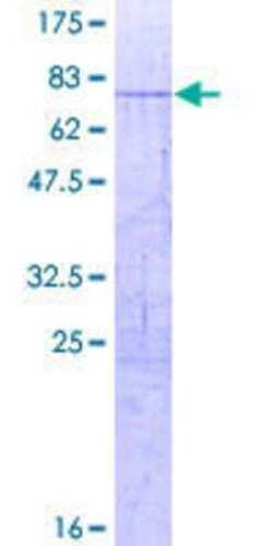 Novus Biologicals Recombinant Human COUP-TF I/NR2F1 GST (N-Term) Protein 2 &mu;g | Buy Online | Novus Biologicals&trade; | Fisher Scientific