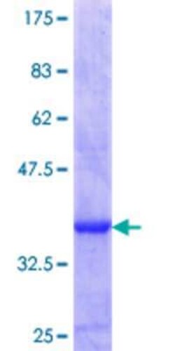 Novus Biologicals Recombinant Human COUP-TF I/NR2F1 GST (N-Term) Protein 25 &mu;g | Buy Online | Novus Biologicals&trade; | Fisher Scientific