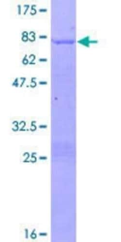Novus Biologicals Recombinant Human COUP-TF II/NR2F2 GST (N-Term) Protein 2 &mu;g | Buy Online | Novus Biologicals&trade; | Fisher Scientific