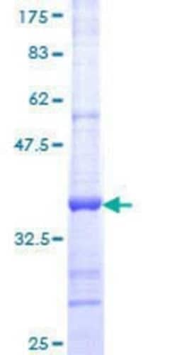 Novus Biologicals Recombinant Human COUP-TF II/NR2F2 GST (N-Term) Protein 10 &mu;g | Buy Online | Novus Biologicals&trade; | Fisher Scientific