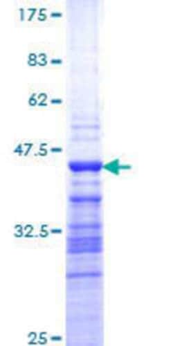 Novus Biologicals Recombinant Human DP2 GST (N-Term) Protein 25 &mu;g | Buy Online | Novus Biologicals&trade; | Fisher Scientific