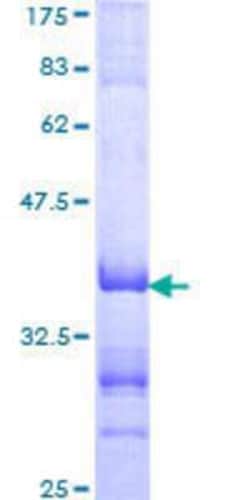 Novus Biologicals Recombinant Human Transcription factor E3 GST (N-Term) Protein 25 &mu;g | Buy Online | Novus Biologicals&trade; | Fisher Scientific