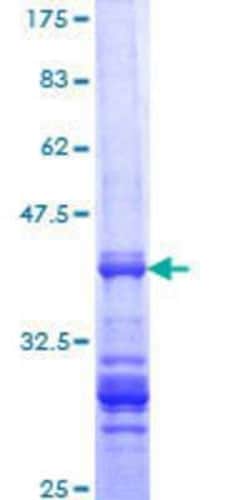 Novus Biologicals Recombinant Human TGIF1 GST (N-Term) Protein 10 &mu;g | Buy Online | Novus Biologicals&trade; | Fisher Scientific