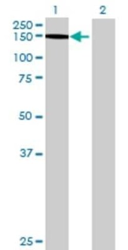 Novus Biologicals Thrombospondin-4 293T Cell Transient Overexpression Lysate 0.1 mL | Buy Online | Novus Biologicals&trade; | Fisher Scientific
