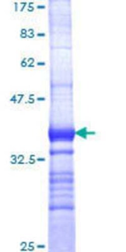 Novus Biologicals Recombinant Human TR alpha/NR1A1/Thyroid Hormone Receptor alpha GST (N-Term) Protein 25 &mu;g | Buy Online | Novus Biologicals&trade; | Fisher Scientific