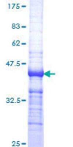 Novus Biologicals Recombinant Human TR beta 1/NR1A2/Thyroid Hormone Receptor beta GST (N-Term) Protein 10 &mu;g | Buy Online | Novus Biologicals&trade; | Fisher Scientific