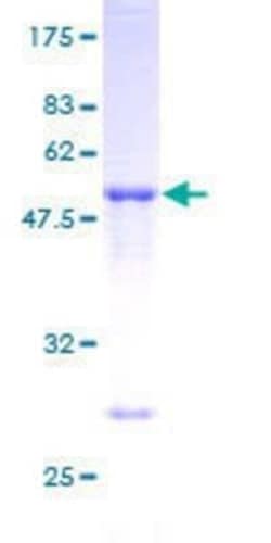 Novus Biologicals Recombinant Human TIA1 GST (N-Term) Protein 10 &mu;g | Buy Online | Novus Biologicals&trade; | Fisher Scientific