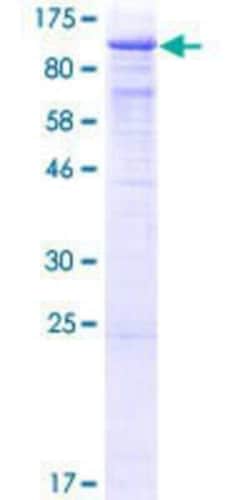 Novus Biologicals Recombinant Human TLE1 GST (N-Term) Protein 25 &mu;g | Buy Online | Novus Biologicals&trade; | Fisher Scientific
