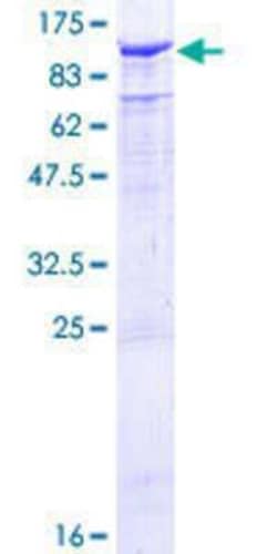 Novus Biologicals Recombinant Human TLE2 GST (N-Term) Protein 10 &mu;g | Buy Online | Novus Biologicals&trade; | Fisher Scientific