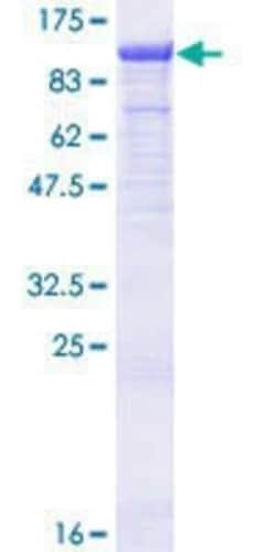 Novus Biologicals Recombinant Human TLE3 GST (N-Term) Protein 25 &mu;g | Buy Online | Novus Biologicals&trade; | Fisher Scientific
