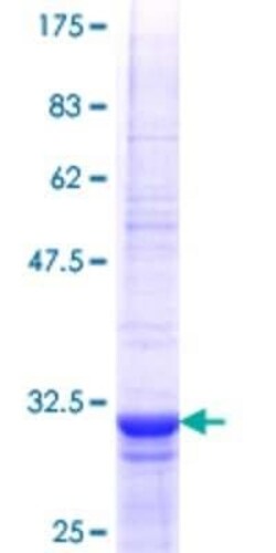 Novus Biologicals Recombinant Human TLL1 GST (N-Term) Protein 10 &mu;g | Buy Online | Novus Biologicals&trade; | Fisher Scientific