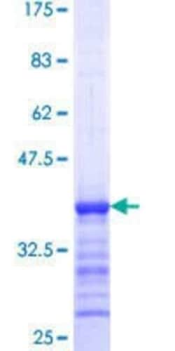 Novus Biologicals Recombinant Human Talin1 GST (N-Term) Protein 10 &mu;g | Buy Online | Novus Biologicals&trade; | Fisher Scientific