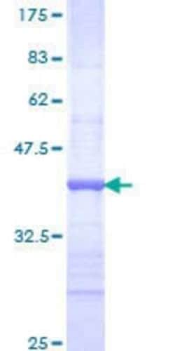Novus Biologicals Recombinant Human TLX/NR2E1 GST (N-Term) Protein 10 &mu;g | Buy Online | Novus Biologicals&trade; | Fisher Scientific