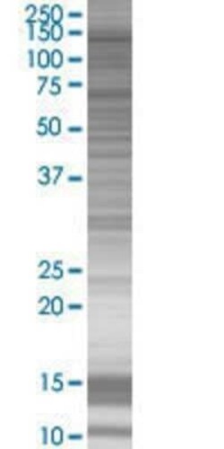 Novus Biologicals TLX/NR2E1 293T Cell Transient Overexpression Lysate 0.1 mL | Buy Online | Novus Biologicals&trade; | Fisher Scientific