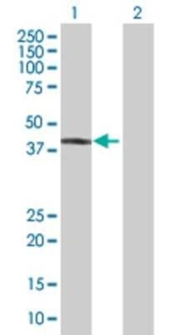 Novus Biologicals TLX/NR2E1 293T Cell Transient Overexpression Lysate 0.1 mL | Buy Online | Novus Biologicals&trade; | Fisher Scientific