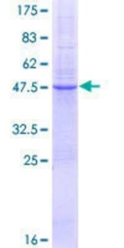 Novus Biologicals Recombinant Human TSPAN8/TM4SF3 GST (N-Term) Protein 25 &mu;g | Buy Online | Novus Biologicals&trade; | Fisher Scientific