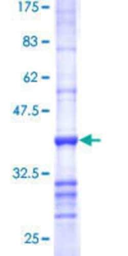 Novus Biologicals Recombinant Human TSPAN8/TM4SF3 GST (N-Term) Protein 25 &mu;g | Buy Online | Novus Biologicals&trade; | Fisher Scientific