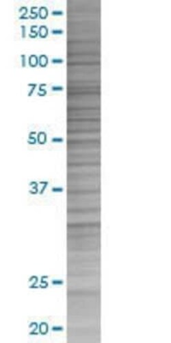 Novus Biologicals TSPAN8/TM4SF3 293T Cell Transient Overexpression Lysate 0.1 mL | Buy Online | Novus Biologicals&trade; | Fisher Scientific