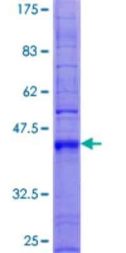 Novus Biologicals&trade;&nbsp;Recombinant Human TM4SF4 GST (N-Term) Protein