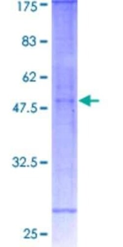 Novus Biologicals Recombinant Human TSPAN6 GST (N-Term) Protein 2 &mu;g | Buy Online | Novus Biologicals&trade; | Fisher Scientific