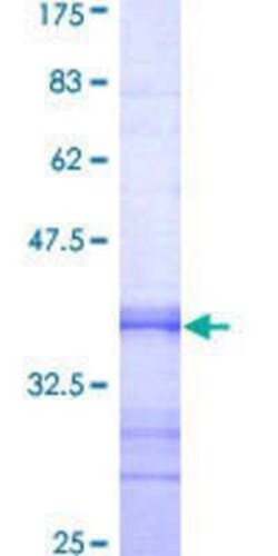 Novus Biologicals Recombinant Human TSPAN6 GST (N-Term) Protein 10 &mu;g | Buy Online | Novus Biologicals&trade; | Fisher Scientific