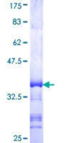 Novus Biologicals Recombinant Human TMEM1 GST (N-Term) Protein 10 &mu;g | Buy Online | Novus Biologicals&trade; | Fisher Scientific